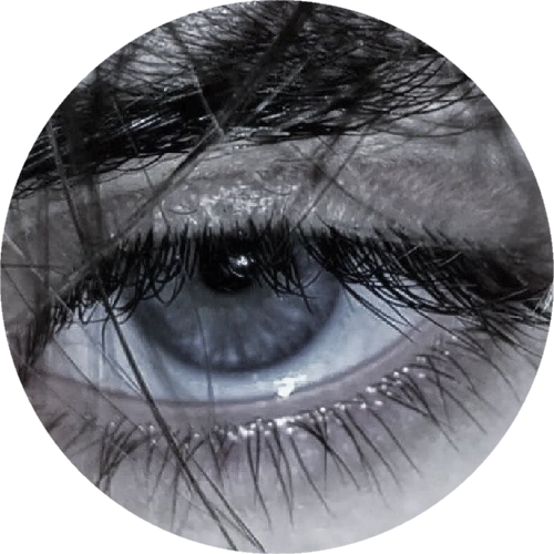AURXLynex69