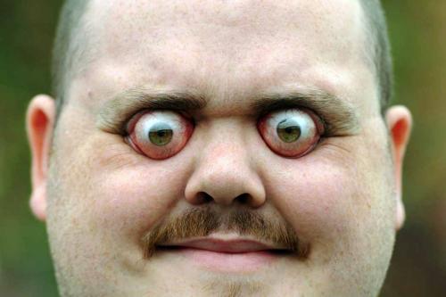 Anarchy Kanielム#Outis