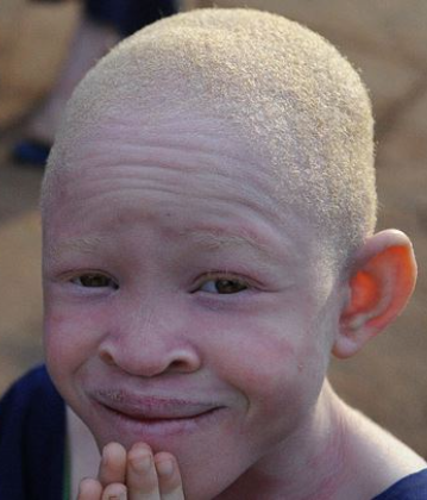 Keçiören Eryaman Konya Gölü